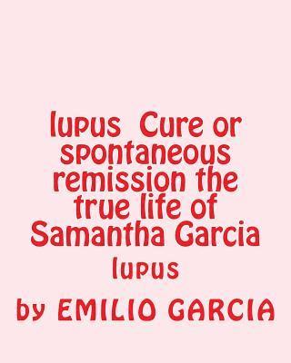 lupus Cure or spontaneous remission the true life of Samantha Garcia: lupus 1