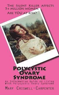bokomslag Polycystic Ovary Syndrome: An Informative Guide on Living With Polycystic Ovary Syndrome