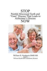 bokomslag Stop Painful Abscessed Teeth and Gum Disease that Leads to Alzheimer's Now.
