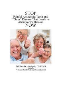bokomslag Stop Painful Abscessed Teeth and Gum Disease that Leads to Alzheimer's Now.