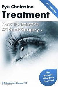 Eye Chalazion: How To Remove Without Surgery: My personal experience and the methods I used for success 1