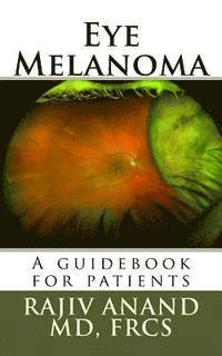 bokomslag Eye Melanoma: A manual for patients