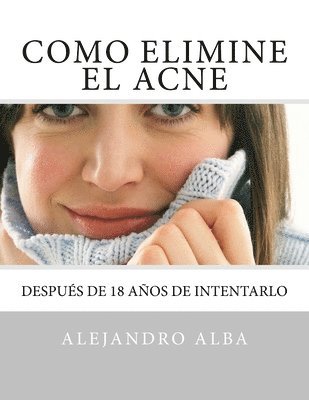 bokomslag Como Elimine el ACNE: Conoce como Eliminé el ACNE después de 18 años de intentarlo - MÉTODO INFALIBLE