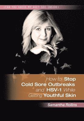 bokomslag How to Stop Cold Sore Outbreaks and HSV-1 While Getting Youthful Skin