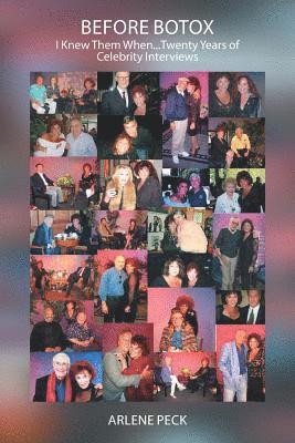 Arlene Peck - Before Botox, Häftad