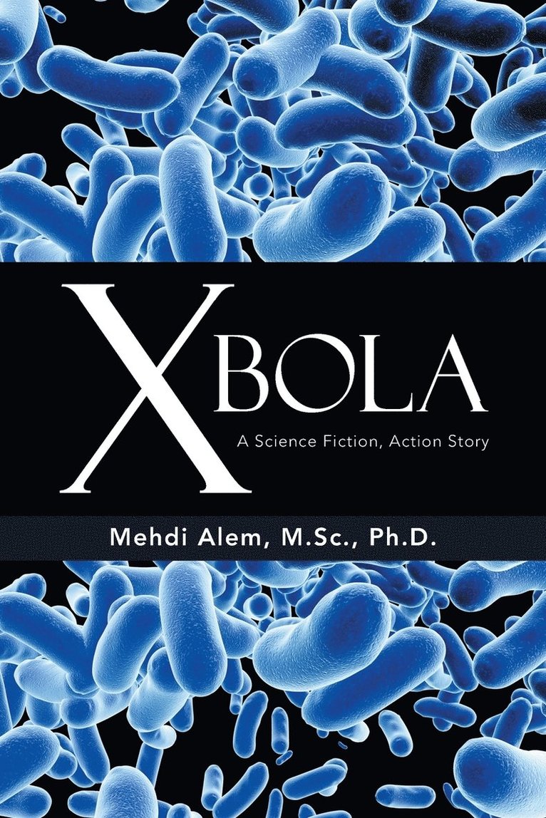 Xbola 1