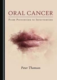 bokomslag Oral Cancer