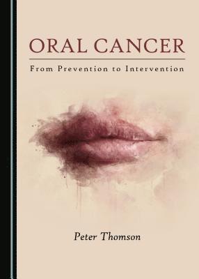 Oral Cancer 1