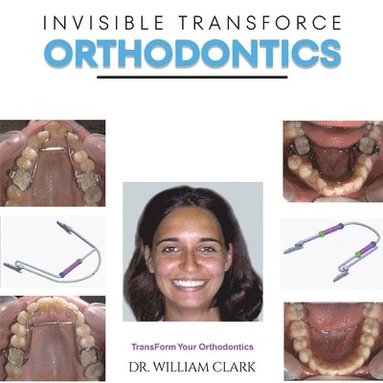 bokomslag Invisible TransForce Orthodontics