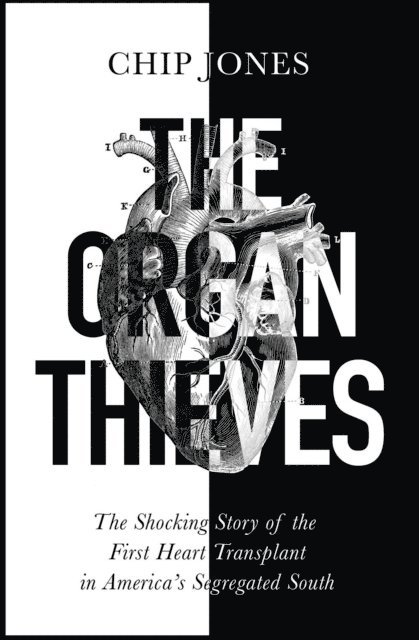 The Organ Thieves 1