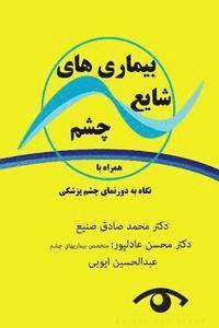 Mohammad Sadegh Sanie, Mohsen Adelpur - Eye Frequent Diseases With a Perspective on Ophthalmology, Häftad