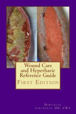 Wound Care and Hyperbaric Reference Guide 1