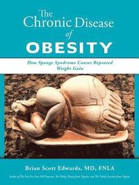 bokomslag The Chronic Disease of Obesity