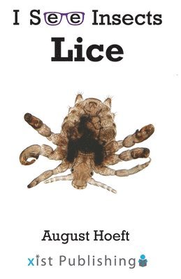 Lice 1