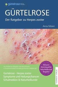 bokomslag Gürtelrose - Der große Ratgeber zu Herpes zoster: Schulmedizin + Naturheilkunde