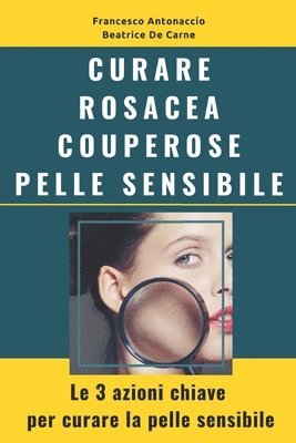 bokomslag Curare Rosacea Couperose e Pelle Sensibile