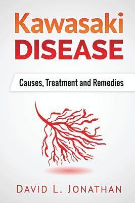 Kawasaki disease - A Slowly Developed Health Issue: Causes, Treatment and Remedies 1