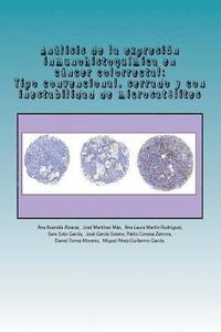 bokomslag Análisis de la expresión inmunohistoquímica en cáncer colorrectal: Tipo convencional, serrado y con inestabilidad de microsatélites