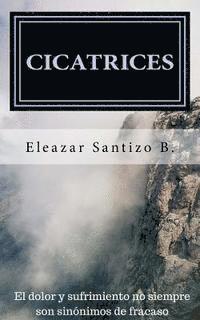 Cicatrices: El Dolor y Sufrimiento no siempre son Sinónimos de Fracaso 1