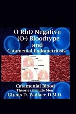 O RhD Negative (O-) Bloodtype And Catamenial Endometriosis: Catamenial Blood Theories Include Men 1