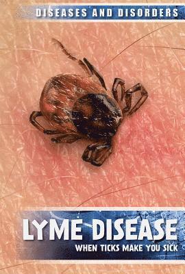 Raymond J. Lampke - Lyme Disease: When Ticks Make You Sick, Inbunden