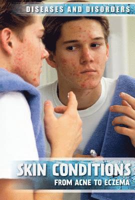 Donna Reynolds - Skin Conditions: From Acne to Eczema, Inbunden
