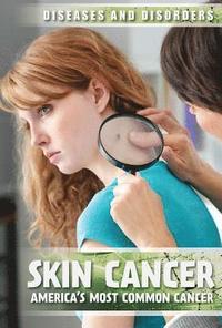 bokomslag Skin Cancer: America's Most Common Cancer