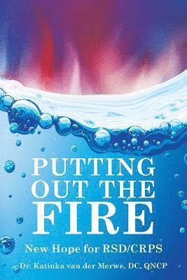 Putting Out the Fire: New Hope for RSD/CRPS 1