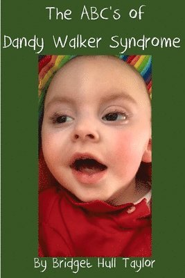 The ABC's of Dandy Walker Syndrome 1