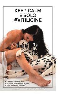 bokomslag Keep Calm È Solo #Vitiligine