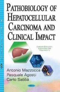 bokomslag Pathobiology of Hepatocellular Carcinoma & Clinical Impact