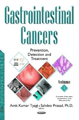 Gastrointestinal Cancers 1