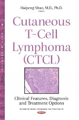 bokomslag Cutaneous T-Cell Lymphoma (CTCL)