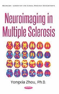 bokomslag Neuroimaging in Multiple Sclerosis