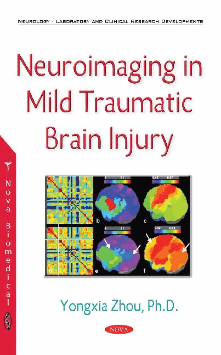 Yongxia Zhou - Neuroimaging in Mild Traumatic Brain Injury, Inbunden