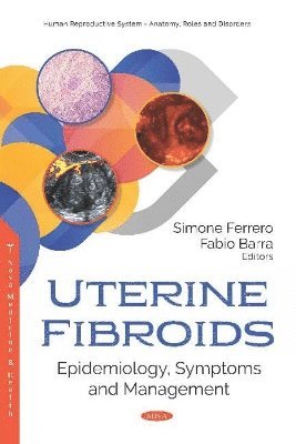 bokomslag Uterine Fibroids