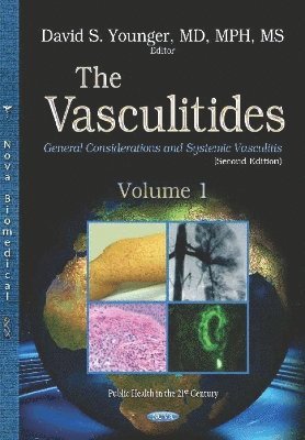 bokomslag Vasculitides