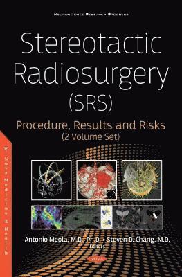 bokomslag Stereotactic Radiosurgery (SRS)