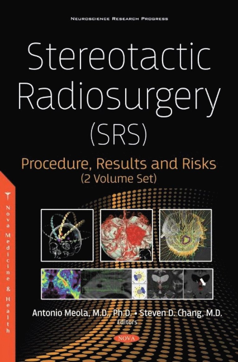 Antonio Meola, PhD Meola, Antonio, MD - Stereotactic Radiosurgery (SRS), Inbunden