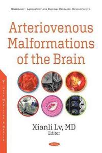 bokomslag Arteriovenous Malformations of the Brain