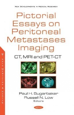 bokomslag Pictorial Essays on Peritoneal Metastases Imaging