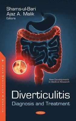 bokomslag Diverticulitis
