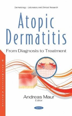 Atopic Dermatitis 1