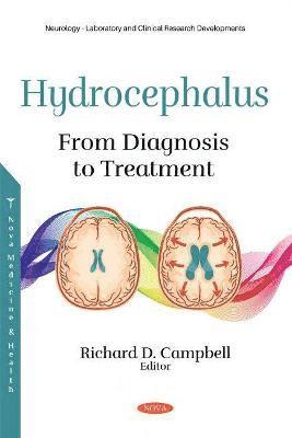 Hydrocephalus 1