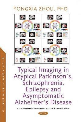 bokomslag Typical Imaging in Atypical Parkinson's, Schizophrenia, Epilepsy and Asymptomatic Alzheimer's Disease