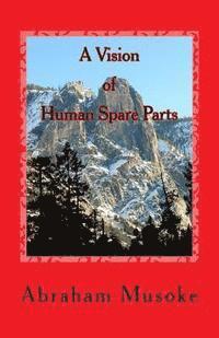 A Vision of Human Spare Parts 1