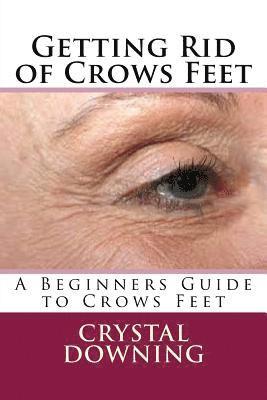Getting Rid of Crows Feet: A Beginners Guide to Crows Feet 1