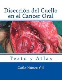 bokomslag Diseccion del Cuello en el Cancer Oral