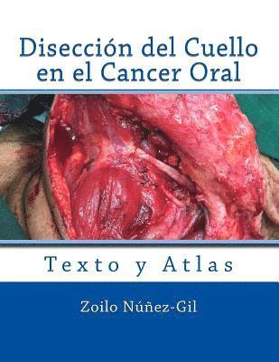 bokomslag Diseccion del Cuello en el Cancer Oral