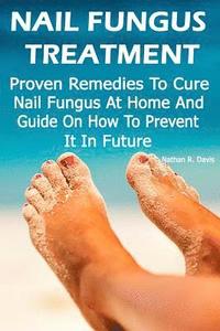 bokomslag Nail Fungus Treatment: Proven Remedies To Cure Nail Fungus At Home And Guide On How To Prevent It In Future: (How to Cure Toenail Fungus)